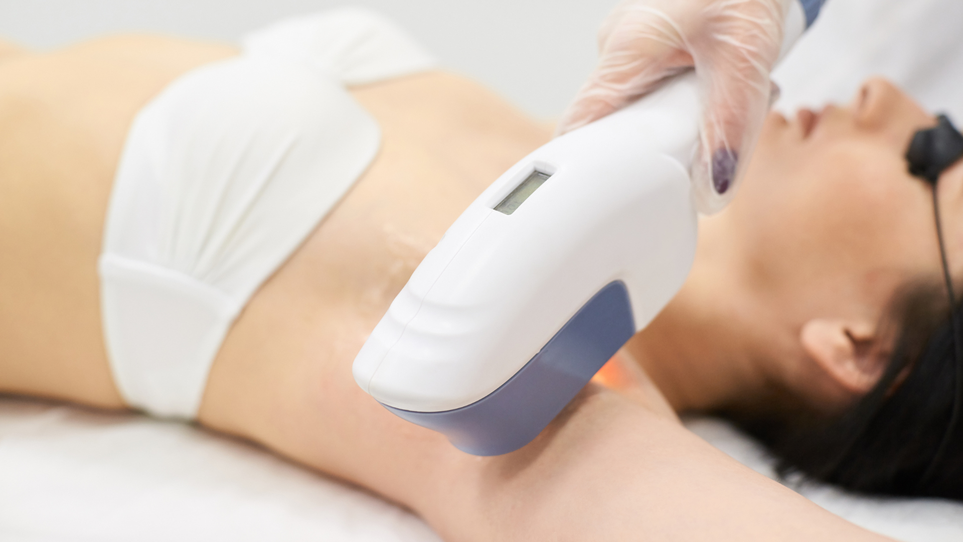 women underarm laser hair removal